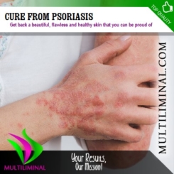 Cure from Psoriasis