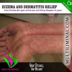 Eczema and Dermatitis Relief