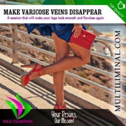 Make Varicose Veins Disappear